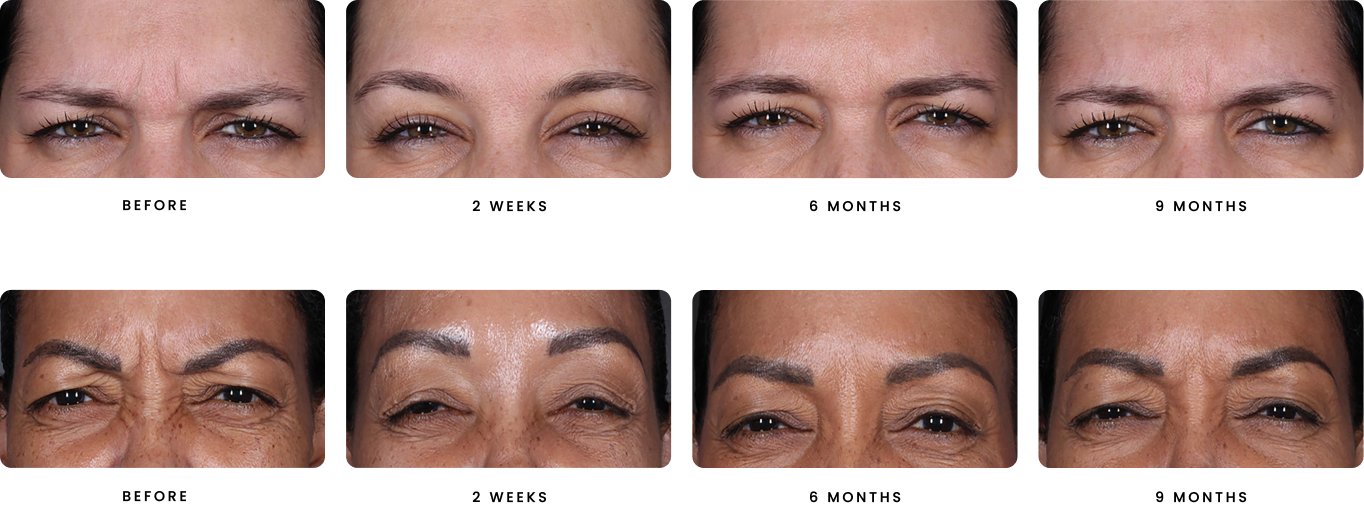B&A Both Sets (1)