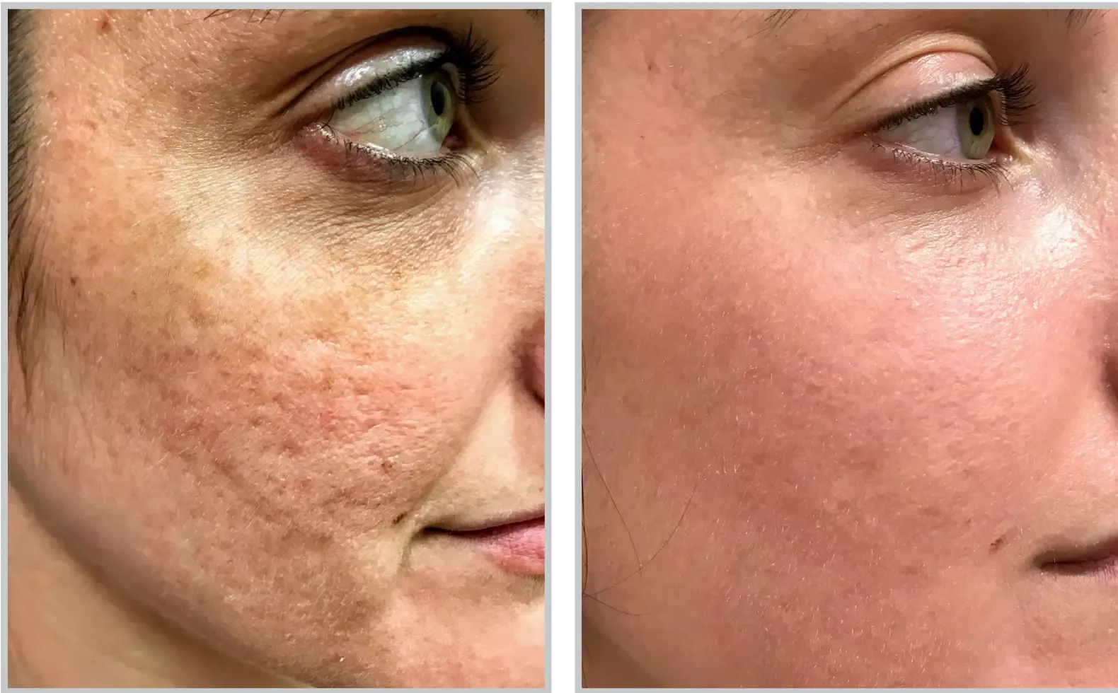 Aesthetic Medicine tampa