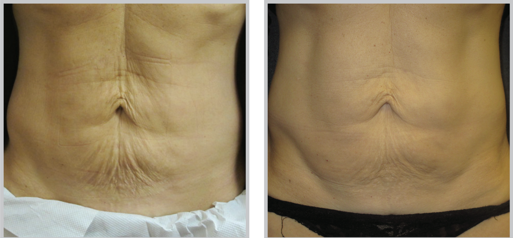 Aesthetic Medicine tampa