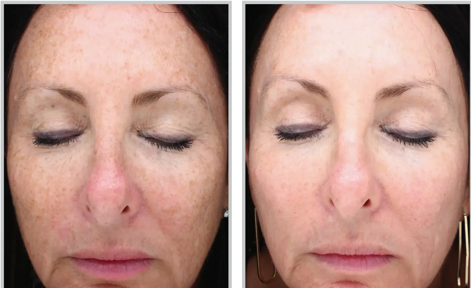 Aesthetic Medicine tampa