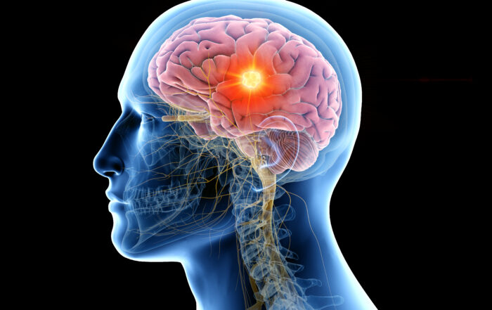 Tampa Peptide Therapy for Brain Health at Tampa Bay Total Wellness Tampa FL