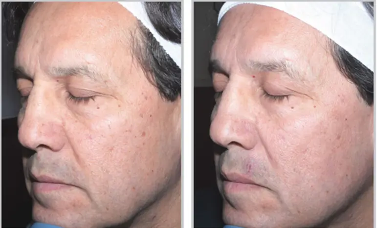 Aesthetic Medicine tampa