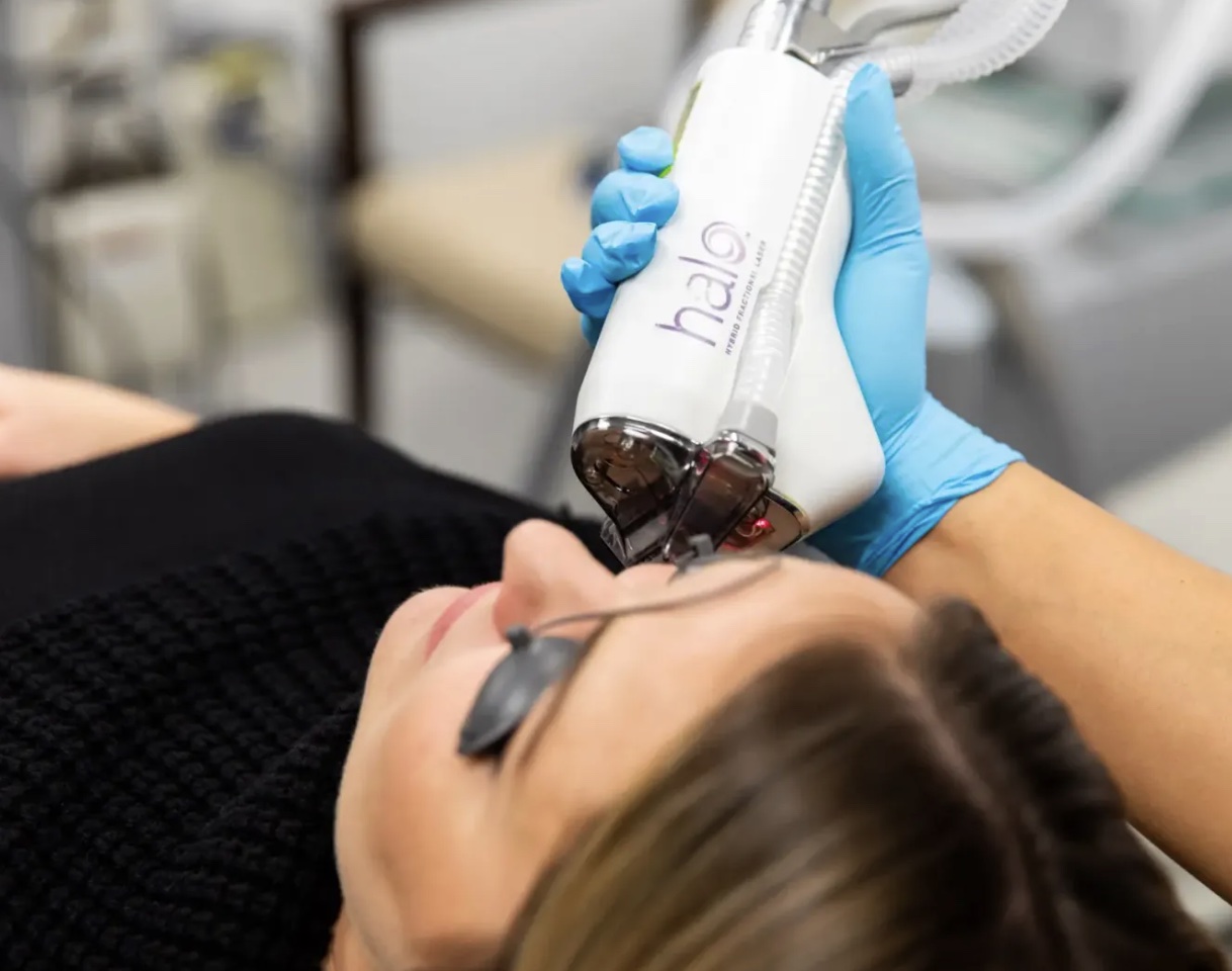 How Do I Choose Between BBL, MOXI, and HALO for Florida Sun Damage