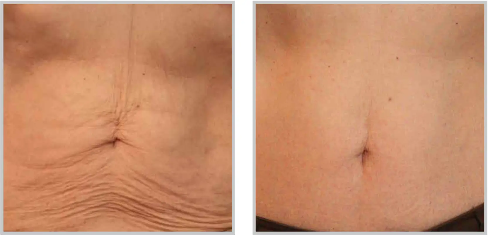 Aesthetic Medicine tampa