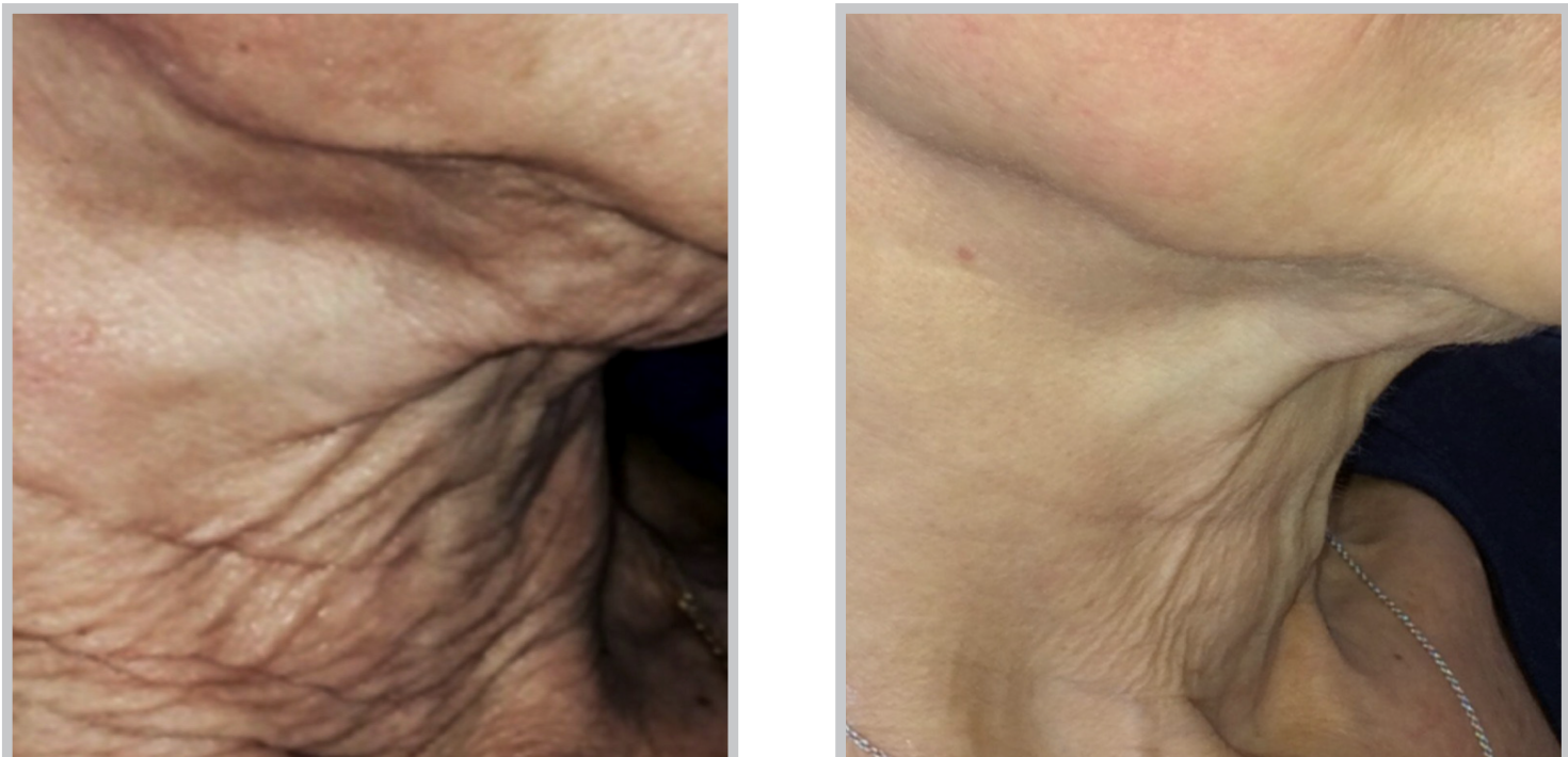 Aesthetic Medicine tampa