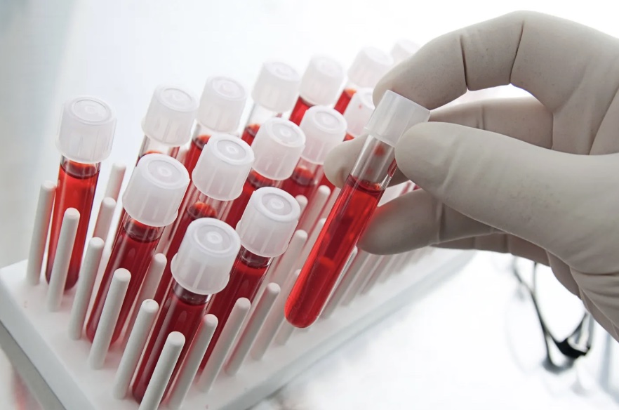 Where to Get an Anti-Aging Blood Panel in Tampa