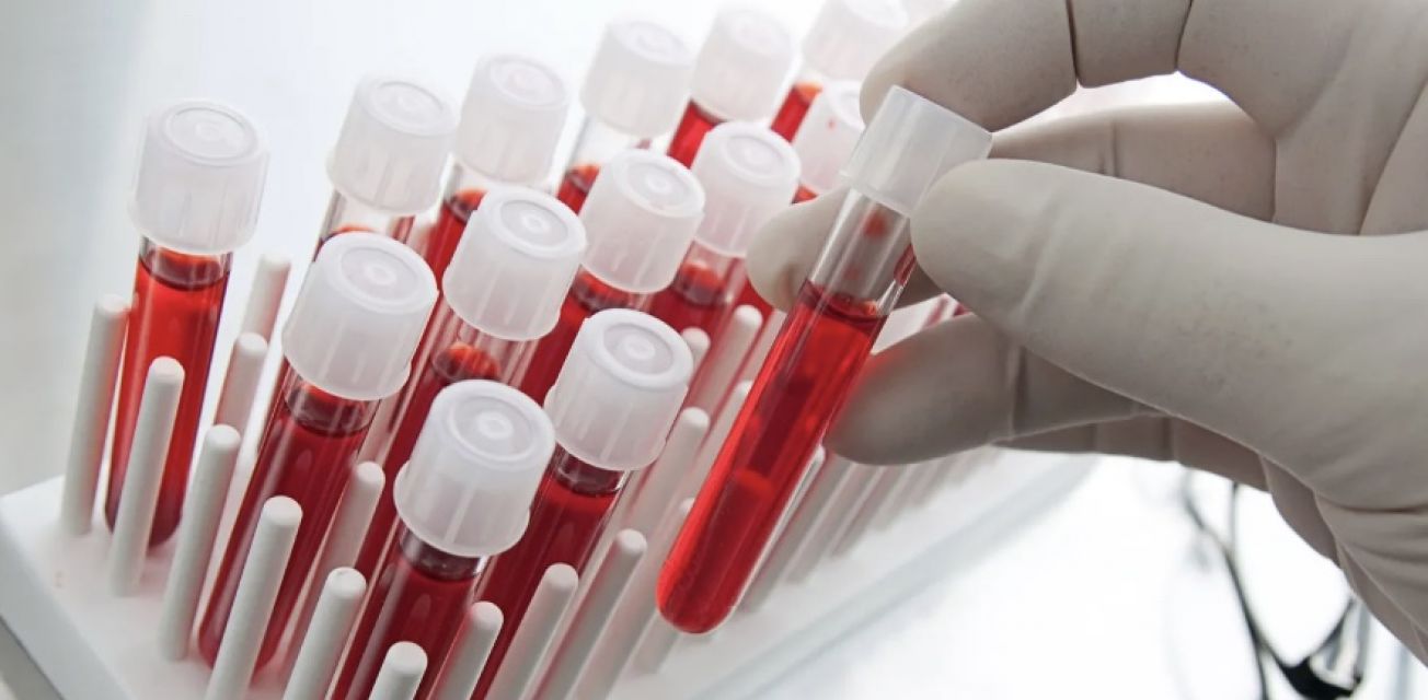 Where to Get an Anti-Aging Blood Panel in Tampa
