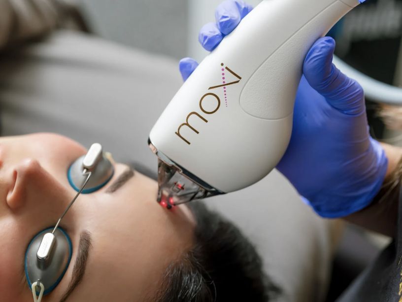 Tampa Med Spa Summer Specials on BBL, HALO and MOXI