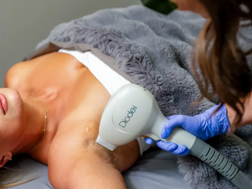 Laser hair removal treatment touch-up session at Tampa Bay Total Wellness using diode laser technology on underarm area