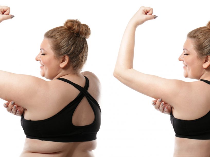 Weight Loss Tampa: A Sustainable Wellness Approach