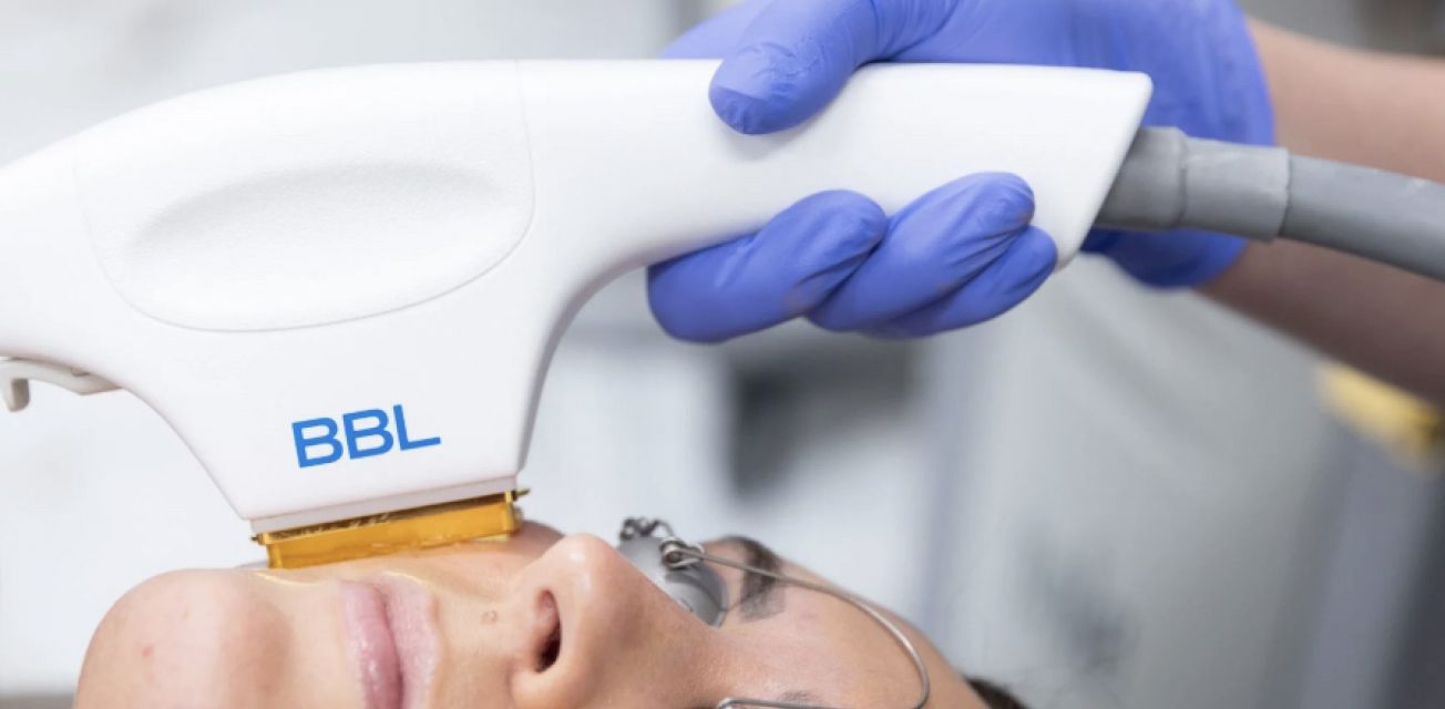 Tampa BBL Hero Laser Treatment Tampa Bay Total Wellness Med Spa Tampa FL