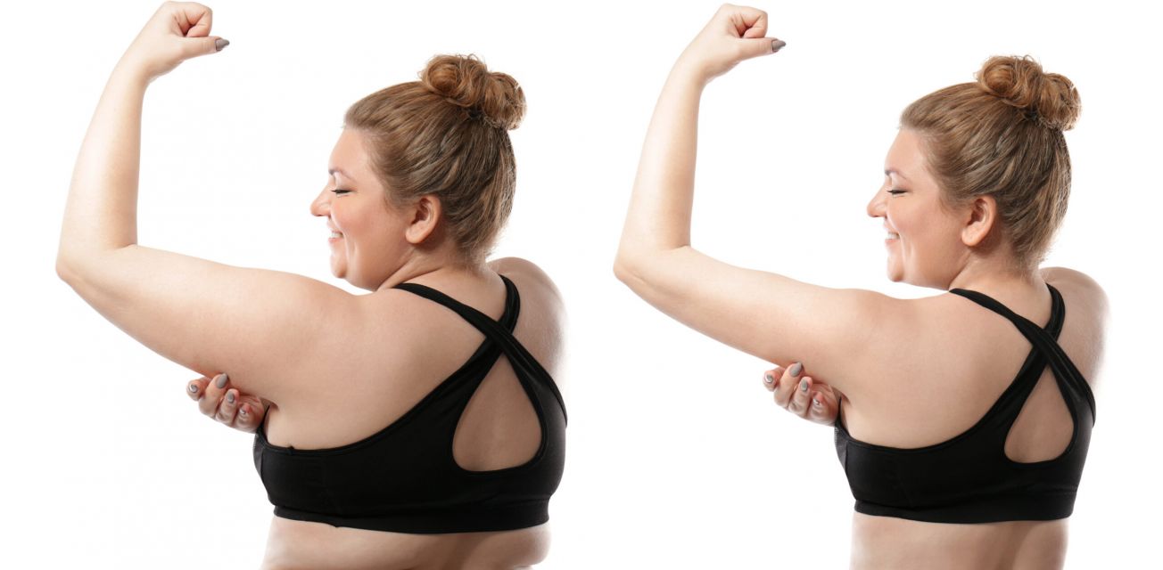 Weight Loss Tampa: A Sustainable Wellness Approach