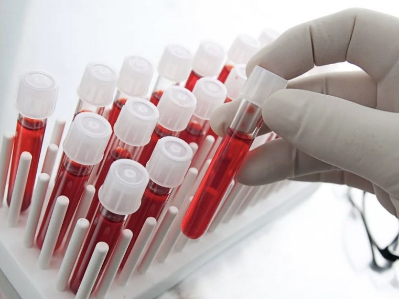 Where to Get an Anti-Aging Blood Panel in Tampa