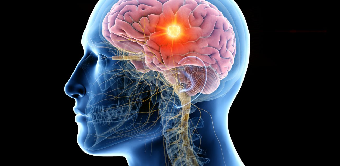 Tampa Peptide Therapy for Brain Health at Tampa Bay Total Wellness Tampa FL