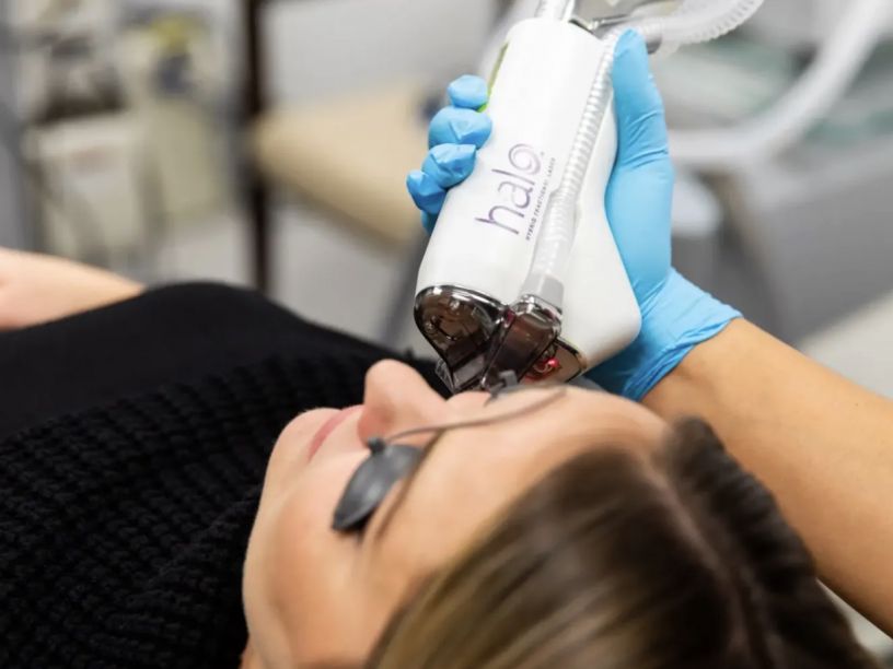 How Do I Choose Between BBL, MOXI, and HALO for Florida Sun Damage